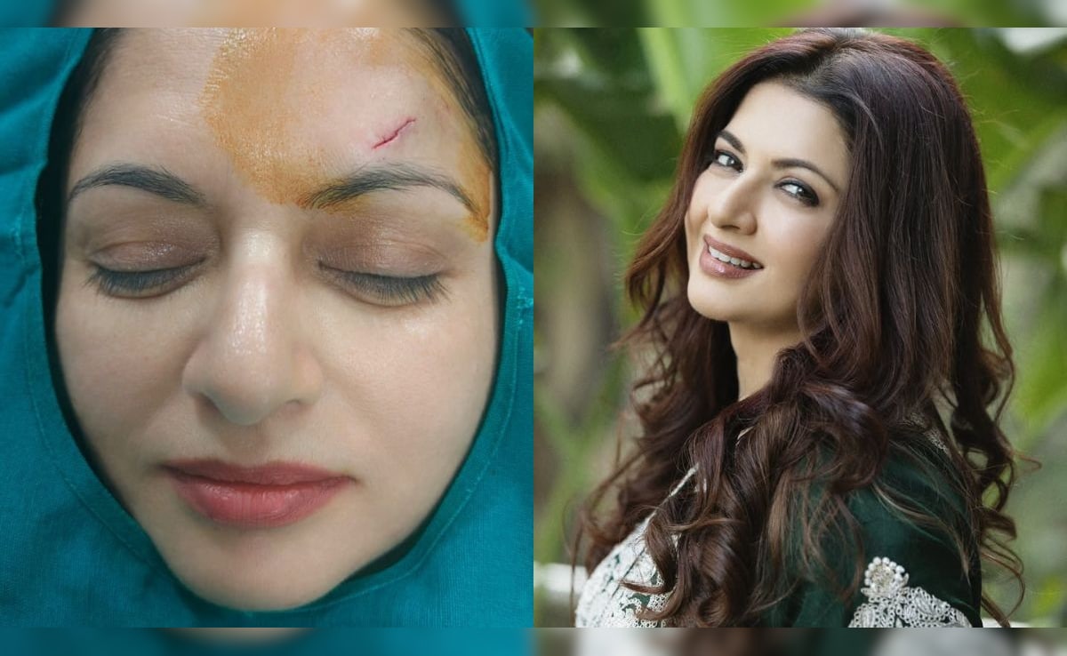 Bhagyashree Gets 13 Stitches After Injuring Her Forehead During A Game Of Pickleball