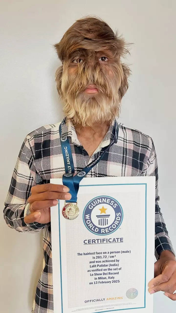 Meet Lalit Patidar: Man with the hairiest face sets Guinness World Record